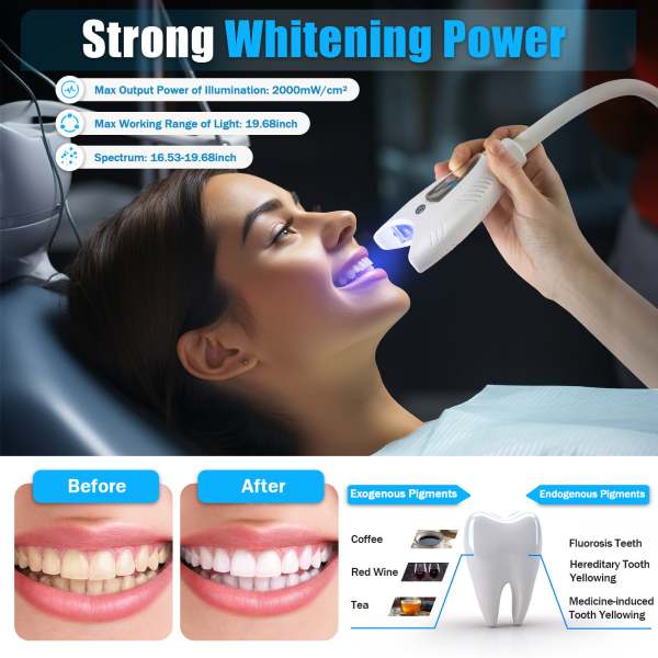 Best CNCEST Teeth Whitening Machine Dental Mobile Lamp Bleaching LED Light Accelerator